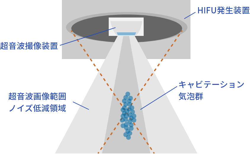 治療イメージ